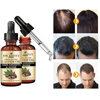 50ml Rytų Aliejų Plaukų Mityba Plaukų Slinkimas Gydymo Sprendimus Produkto Plaukų Augimą Ištaisyti Esmė Aliejus Plaukų Atauga Produktus